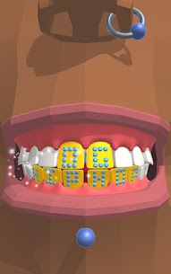 Dentist Bling MOD APK Unlimited Money 1.0.2 5